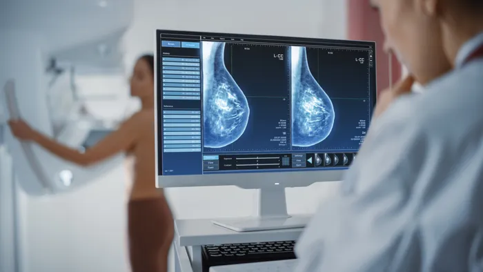 breast